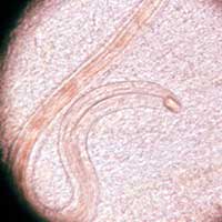 Nematodes